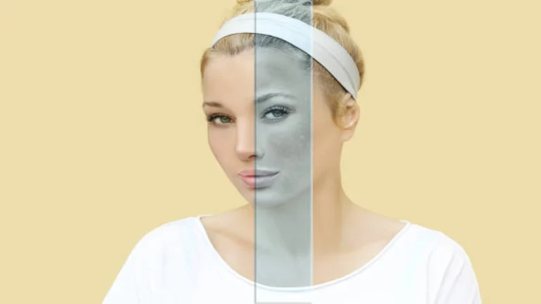 Skin Discoloration Causes What's Really Behind Your Changing Skin Tone
